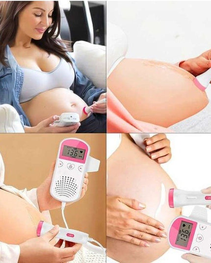 Monitor Fetal Doppler, Monitorizare Sarcina, Ritm Cardiac, Ecran LCD 4.5 cm, 2 x Baterii AA (neincluse), Portabil, din ABS, 12.8 x 9.6 x 3 cm, Utilizare de la 9 Saptamani