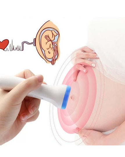 Monitor Fetal Doppler, Monitorizare Sarcina, Ritm Cardiac, Ecran LCD 4.5 cm, 2 x Baterii AA (neincluse), Portabil, din ABS, 12.8 x 9.6 x 3 cm, Utilizare de la 9 Saptamani